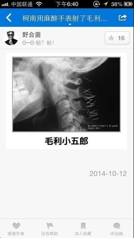 突然有一天，毛利小五郎觉得脖子很不舒服……[吃惊]